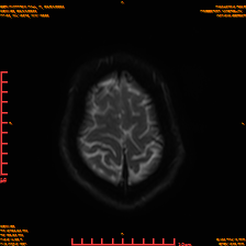 2025-06-14/sDWI B0/0023-IM988.png