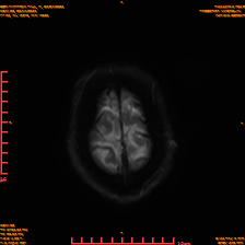 2025-06-14/sDWI B0/0024-IM989.png