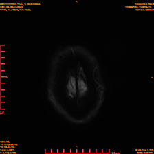 2025-06-14/sDWI B0/0025-IM990.png