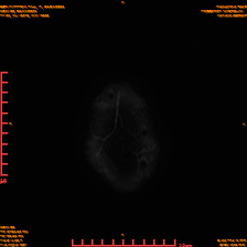 2025-06-14/sDWI B0/0026-IM991.png