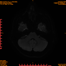 2025-06-14/sDWI B1000/0007-IM946.png