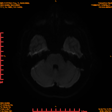 2025-06-14/sDWI B1000/0008-IM947.png