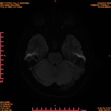 2025-06-14/sDWI B1000/0009-IM948.png