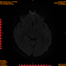 2025-06-14/sDWI B1000/0012-IM951.png