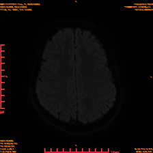 2025-06-14/sDWI B1000/0019-IM958.png
