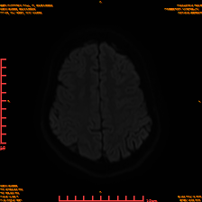 2025-06-14/sDWI B1000/0020-IM959.png
