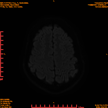 2025-06-14/sDWI B1000/0021-IM960.png
