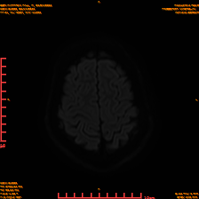 2025-06-14/sDWI B1000/0022-IM961.png