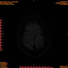 2025-06-14/sDWI B1000/0023-IM962.png