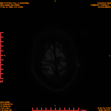 2025-06-14/sDWI B1000/0024-IM963.png
