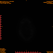 2025-06-14/sDWI B1000/0026-IM965.png