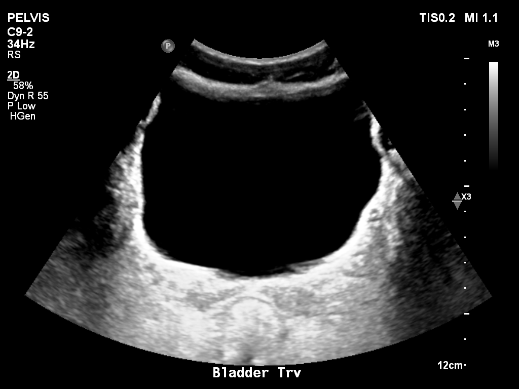 2025-11-03/Bladder Ultrasound/0002-.png