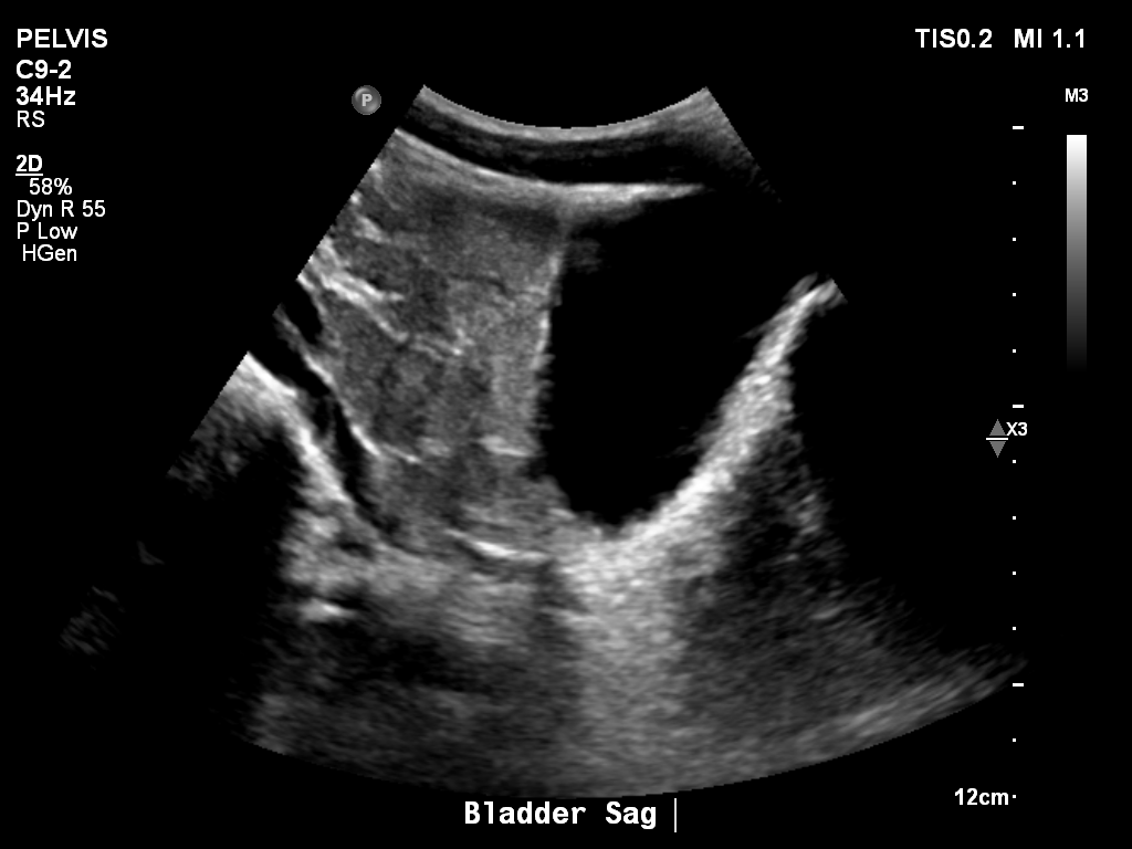 2025-11-03/Bladder Ultrasound/0008-.png