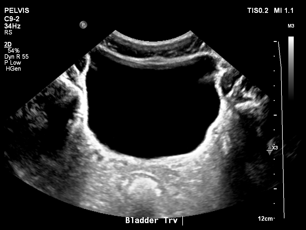 2025-11-03/Bladder Ultrasound/0017-.png