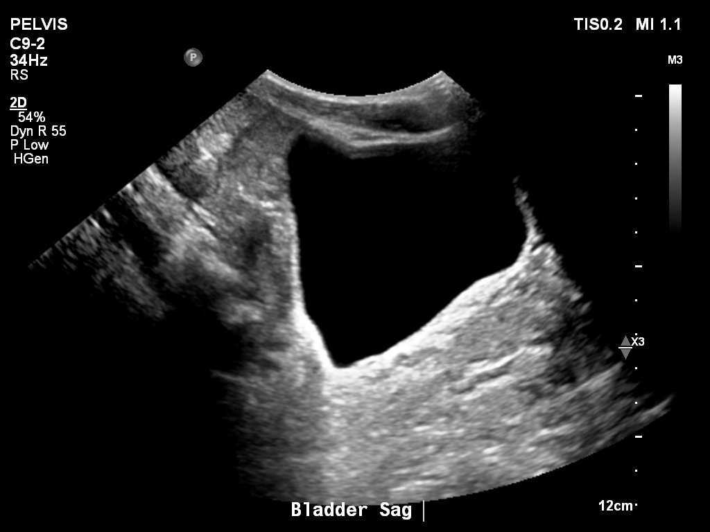 2025-11-03/Bladder Ultrasound/0021-.png