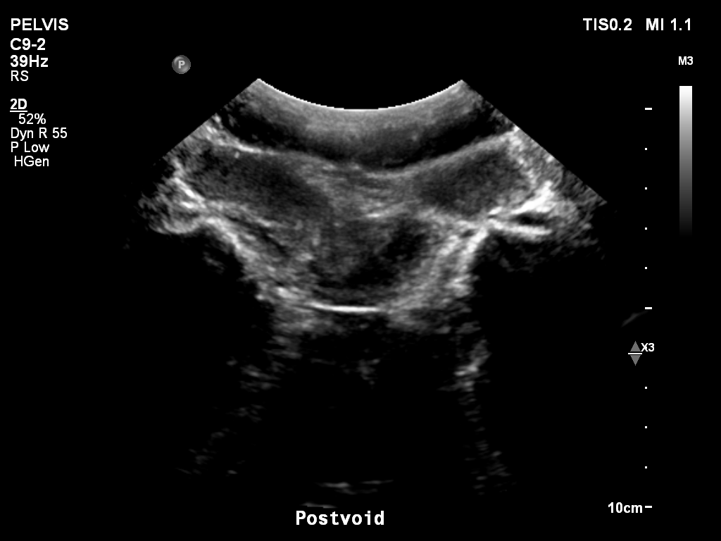 2025-11-03/Bladder Ultrasound/0025-.png