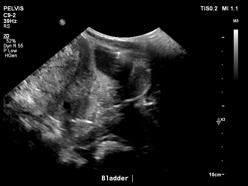 2025-11-03/Bladder Ultrasound/0026-.png