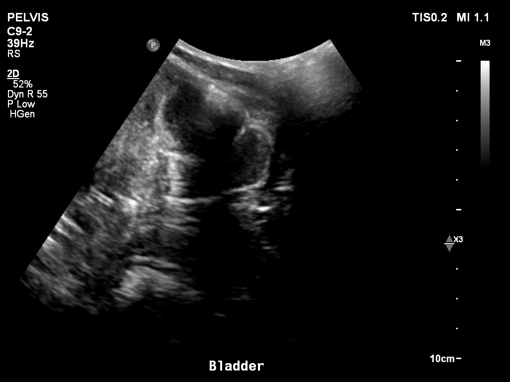 2025-11-03/Bladder Ultrasound/0027-.png