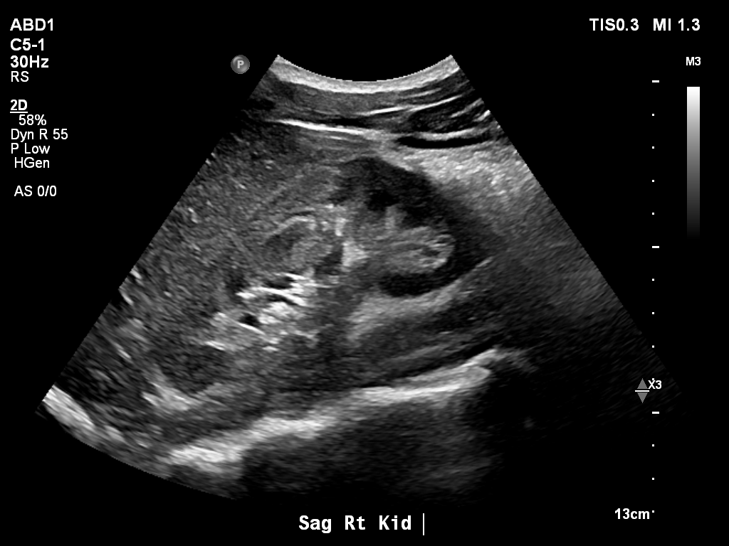 2025-11-03/Kidneys Ultrasound/0002-.png