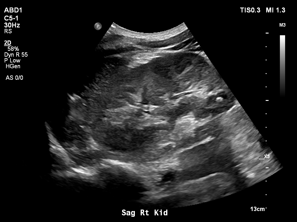 2025-11-03/Kidneys Ultrasound/0003-.png
