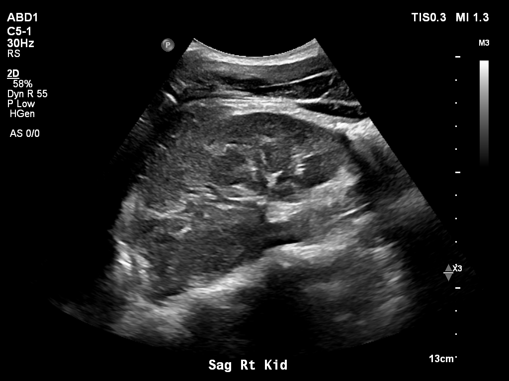 2025-11-03/Kidneys Ultrasound/0004-.png
