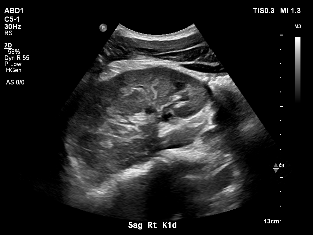 2025-11-03/Kidneys Ultrasound/0005-.png
