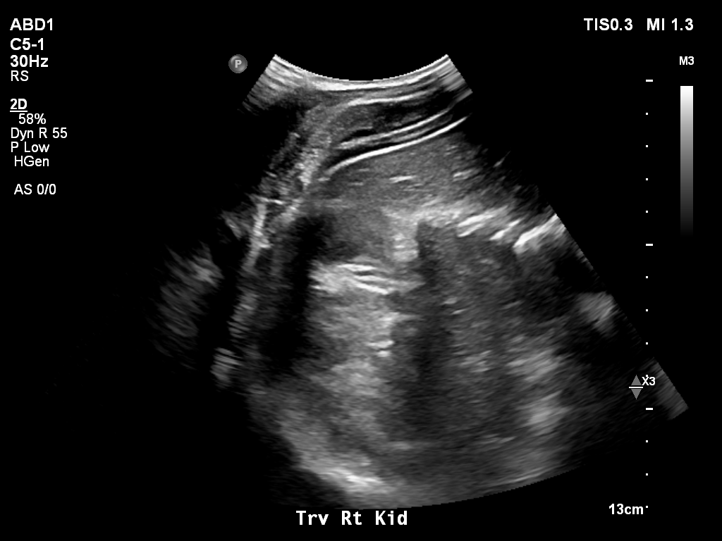 2025-11-03/Kidneys Ultrasound/0006-.png