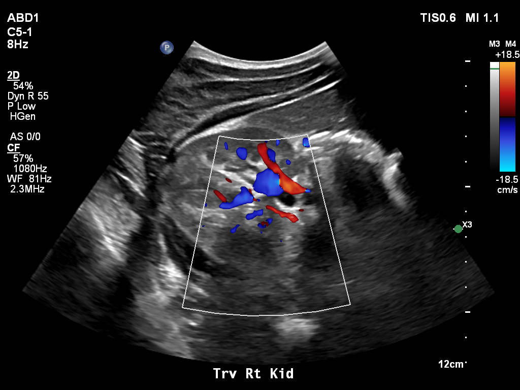 2025-11-03/Kidneys Ultrasound/0009-.png