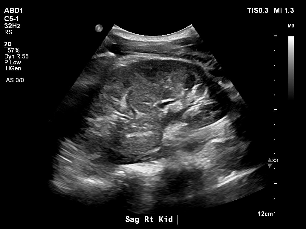2025-11-03/Kidneys Ultrasound/0010-.png