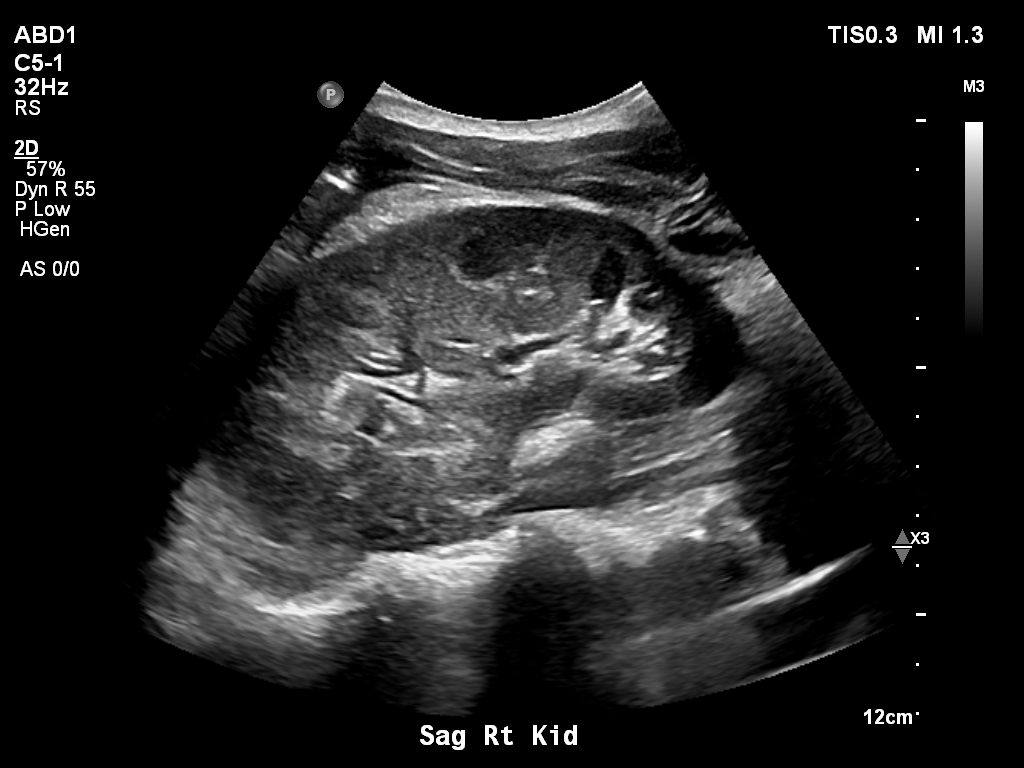 2025-11-03/Kidneys Ultrasound/0012-.png