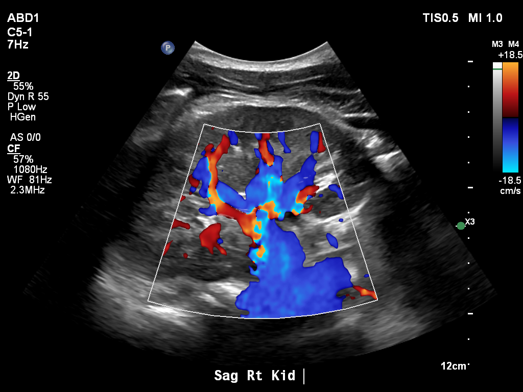 2025-11-03/Kidneys Ultrasound/0013-.png