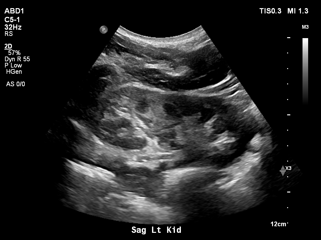 2025-11-03/Kidneys Ultrasound/0014-.png