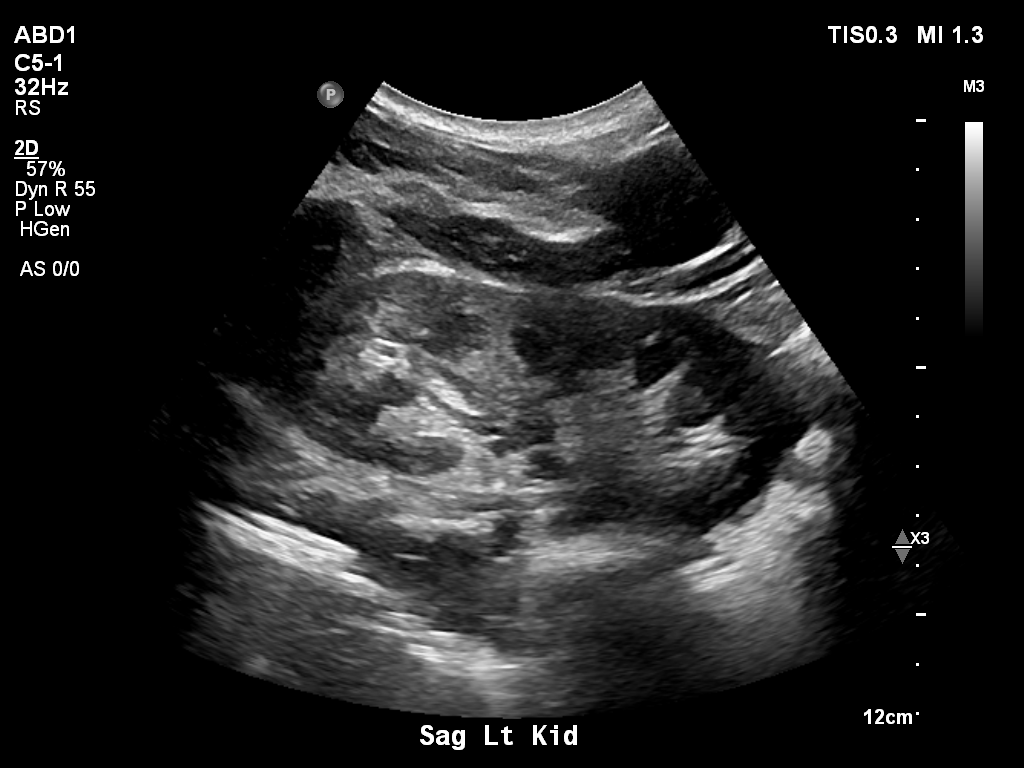 2025-11-03/Kidneys Ultrasound/0015-.png