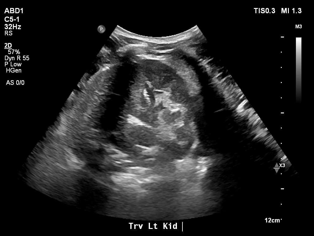 2025-11-03/Kidneys Ultrasound/0016-.png
