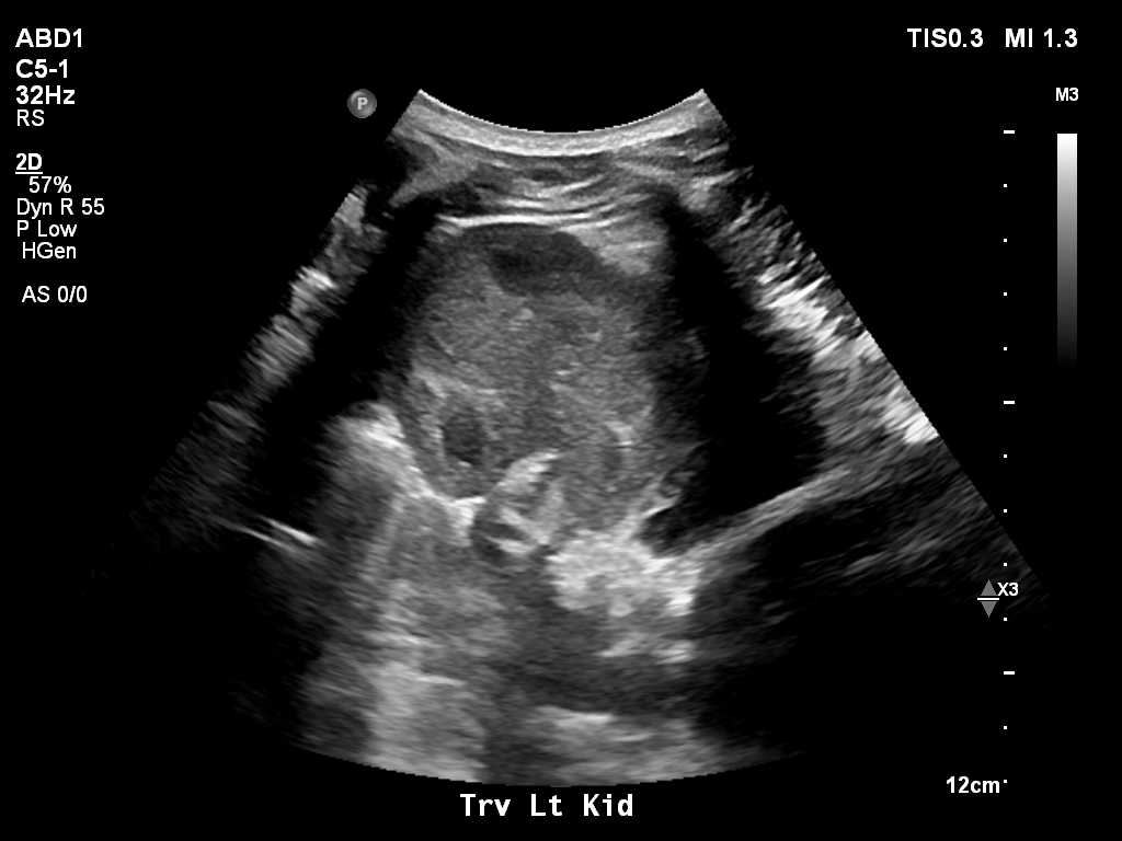 2025-11-03/Kidneys Ultrasound/0017-.png