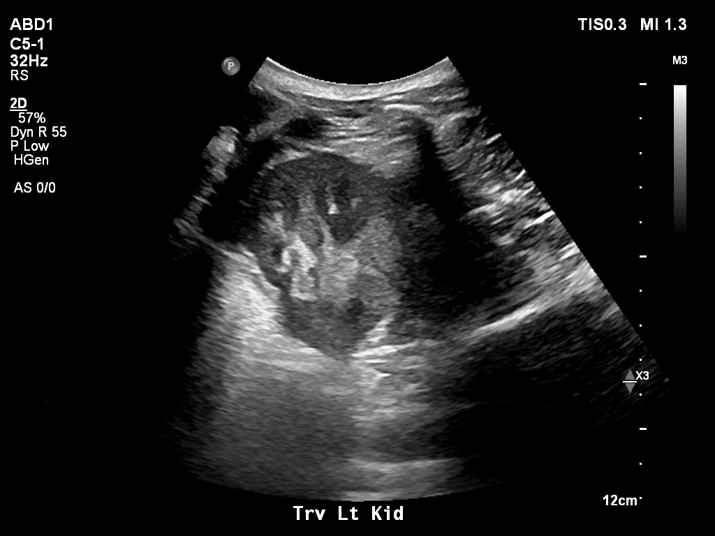 2025-11-03/Kidneys Ultrasound/0018-.png