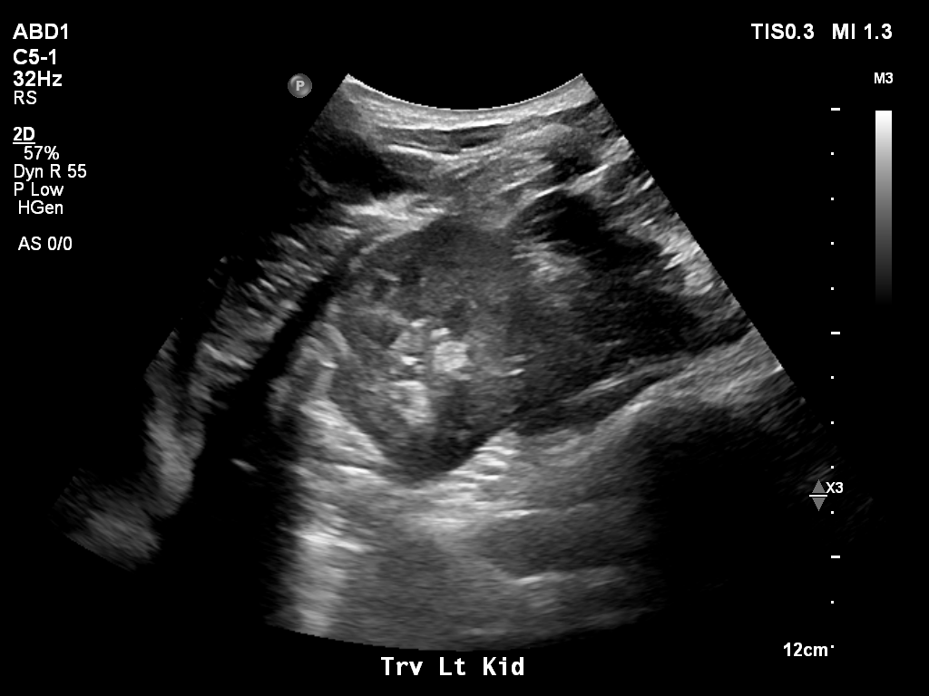 2025-11-03/Kidneys Ultrasound/0019-.png