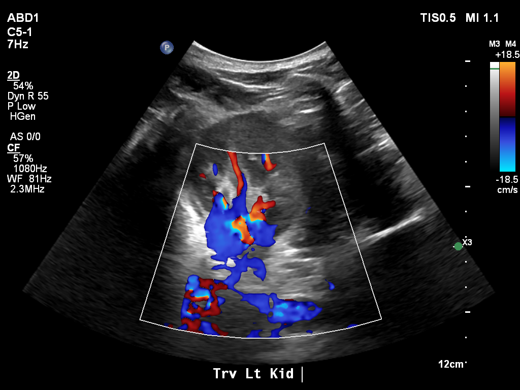 2025-11-03/Kidneys Ultrasound/0020-.png