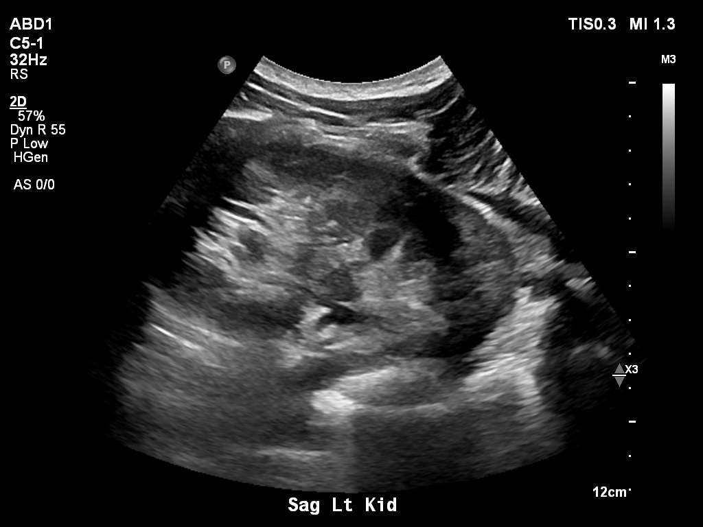 2025-11-03/Kidneys Ultrasound/0021-.png