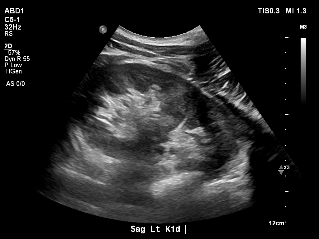 2025-11-03/Kidneys Ultrasound/0022-.png