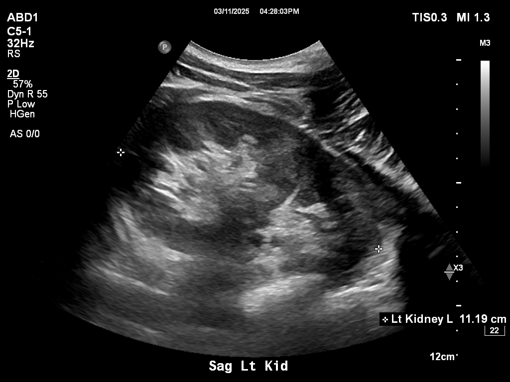 2025-11-03/Kidneys Ultrasound/0023-.png