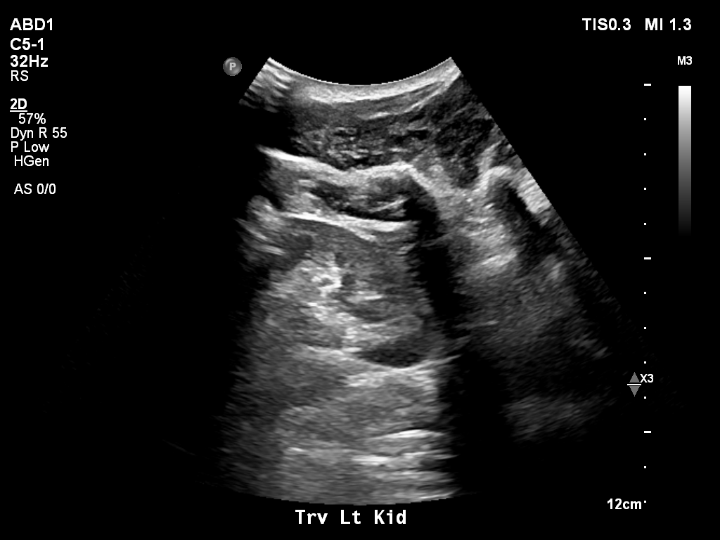 2025-11-03/Kidneys Ultrasound/0024-.png