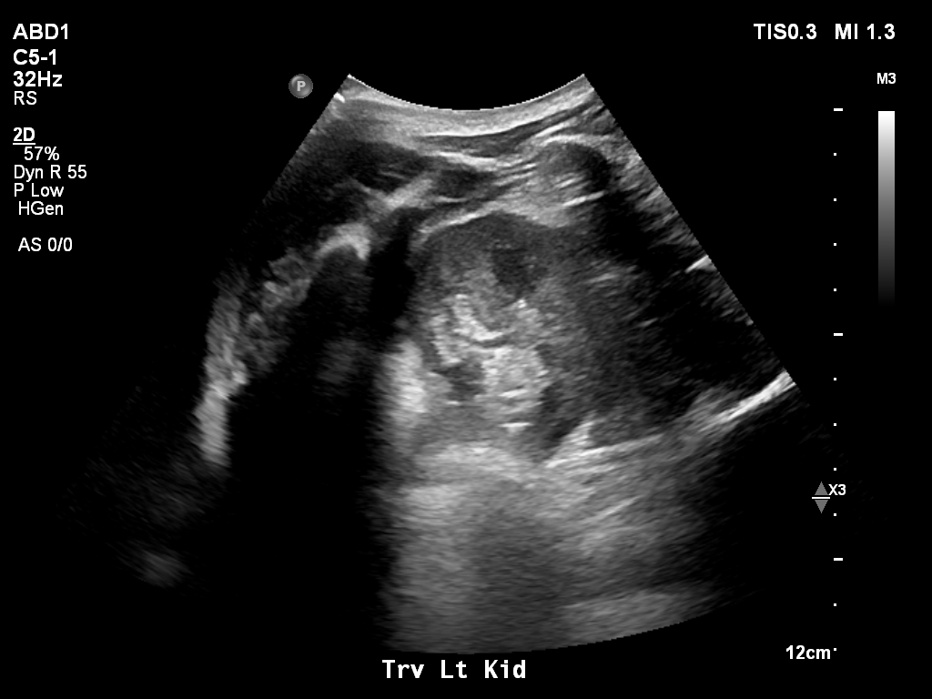 2025-11-03/Kidneys Ultrasound/0025-.png