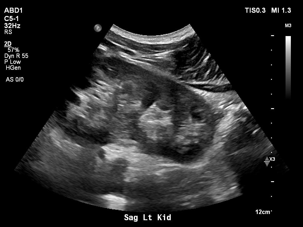 2025-11-03/Kidneys Ultrasound/0026-.png