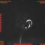 2026-04-15/Brain/AAHead Scout/0002-.png