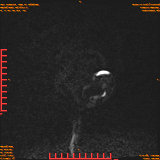 2026-04-15/Brain/AAHead Scout/0003-.png