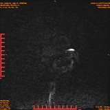 2026-04-15/Brain/AAHead Scout/0004-.png