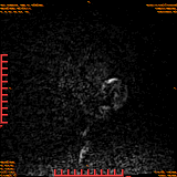 2026-04-15/Brain/AAHead Scout/0005-.png