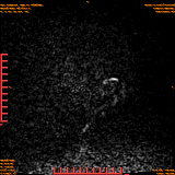 2026-04-15/Brain/AAHead Scout/0006-.png