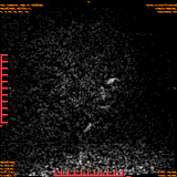 2026-04-15/Brain/AAHead Scout/0007-.png